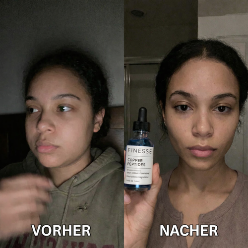 FINESSE PARIS® - SKIN ELIXIR